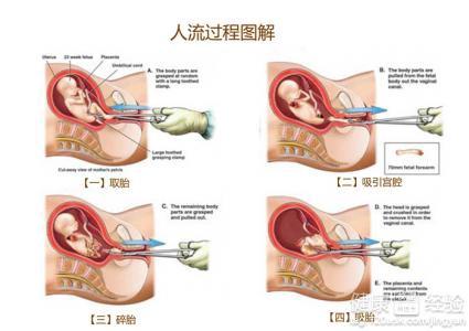 药流后半个月掉大血块，原因、处理与预防