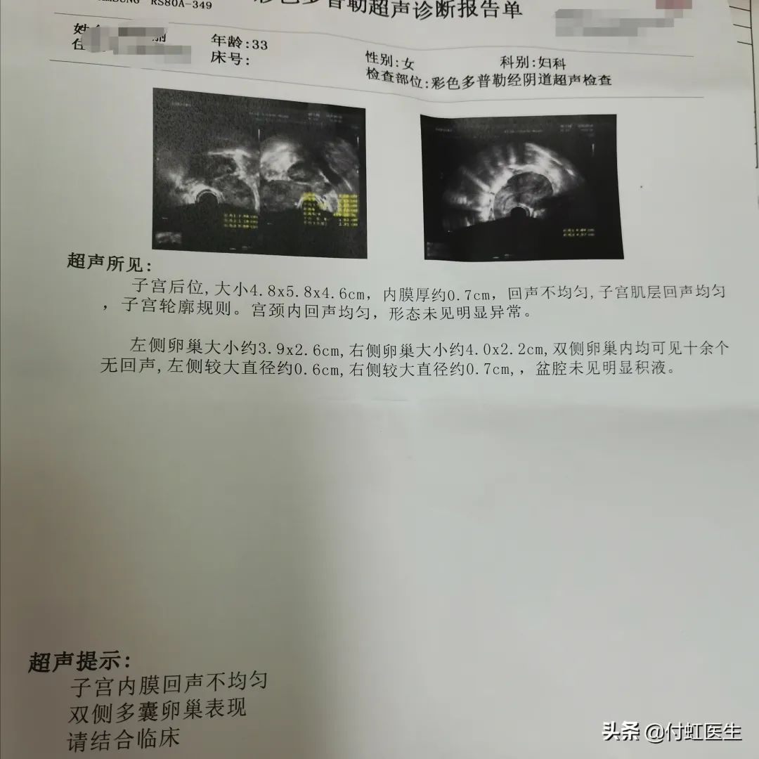 本月排卵期未见白带，探寻原因与关注健康